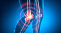New Discoveries in Rheumatoid Arthritis: Beyond Inflammation