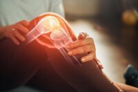 Unconventional Treatments for Effective Knee Arthritis Relief
