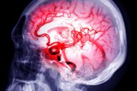 Testosterone May Help Shield Against Deadly Brain Cancer, Say Scientists