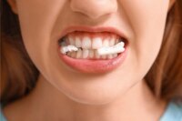 Scientists Create Bioengineered Gum to Combat Oral Cancer