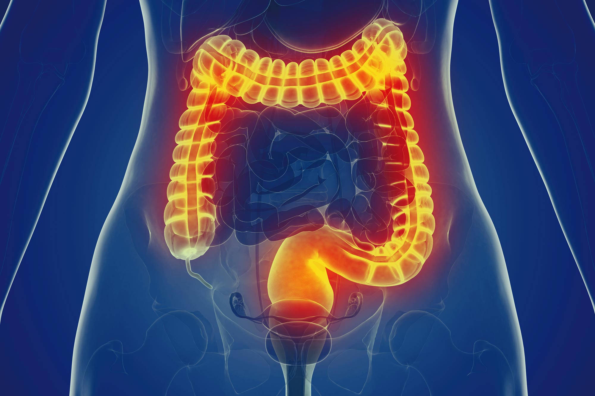 Scientists Discover Immune System Switch to Halt Gut Inflammation