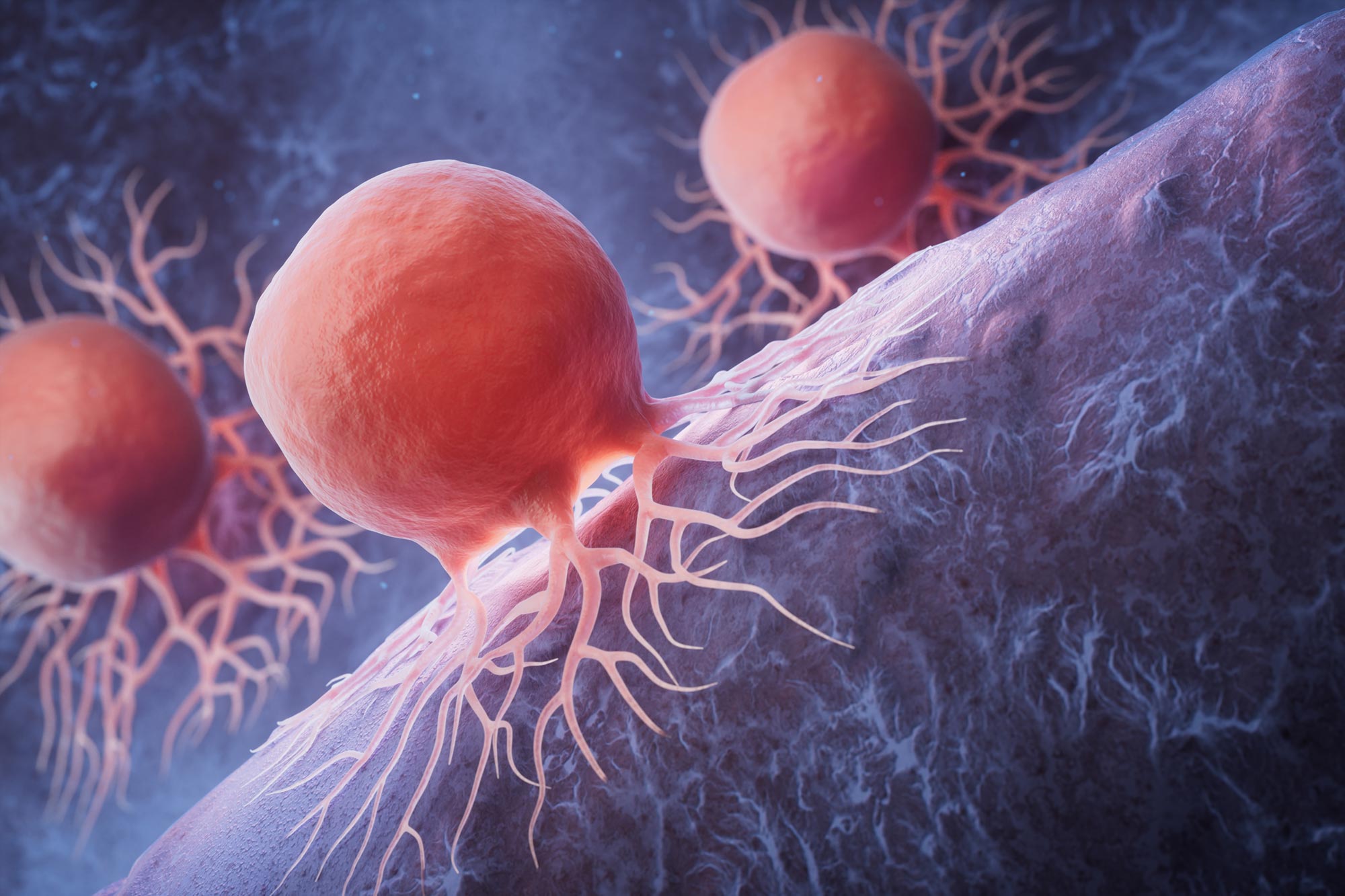 New Study Uncovers Surprising Method to Eradicate Pancreatic Cancer Cells