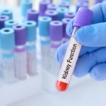 Normal Kidney Test May Indicate Serious Health Risks