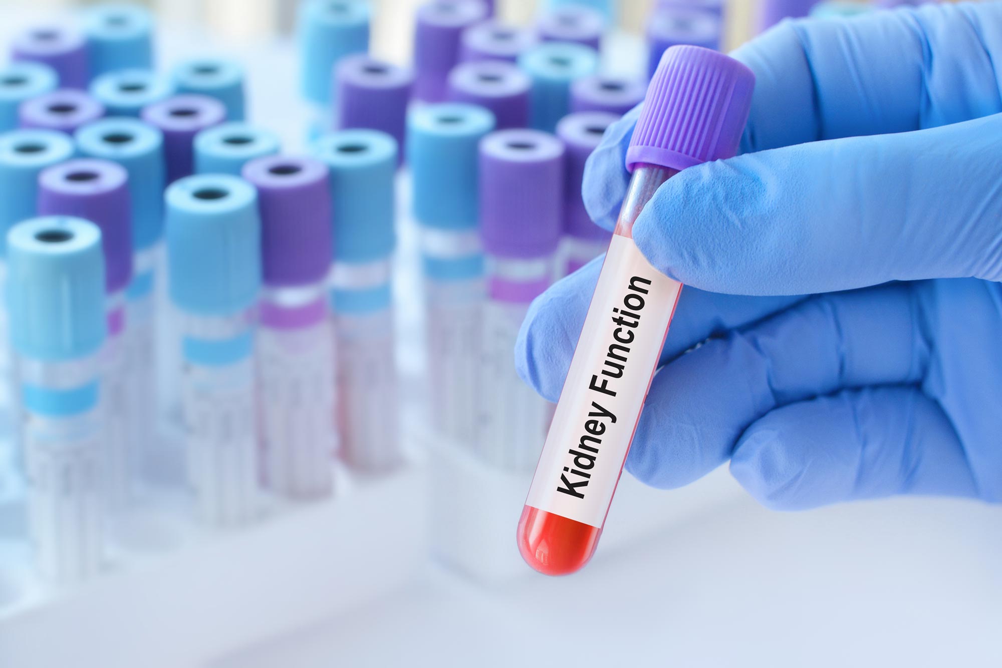 Normal Kidney Test May Indicate Serious Health Risks