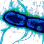 Scientists Identify “Achilles’ Heel” of Deadly Diarrhea Bacteria