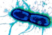 Scientists Identify “Achilles’ Heel” of Deadly Diarrhea Bacteria