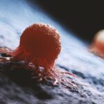 Scientists Discover Hidden Switch Behind Colon Cancer’s Liver Spread