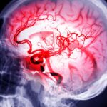 Scientists Uncover New Method for Brain Recovery Post-Stroke