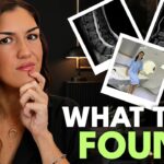 Unexpected Findings from My Full-Body Preventative MRI