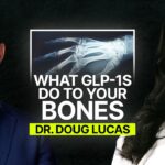 5 Surprising Causes of Bone Loss: What to Know – Dr. Lucas | GLS #222
