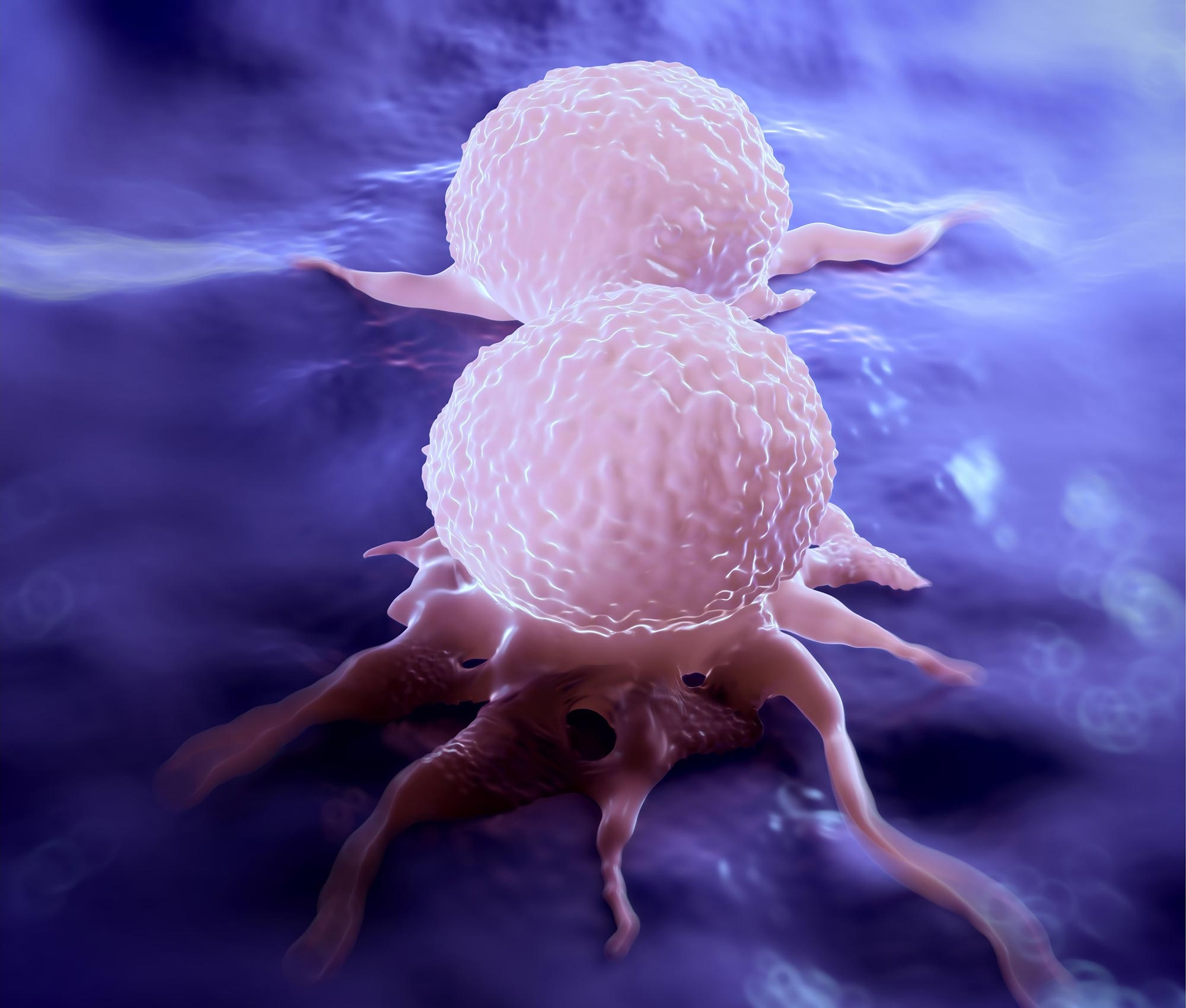 Emerging Breast Cancer Trends in Asian American Communities