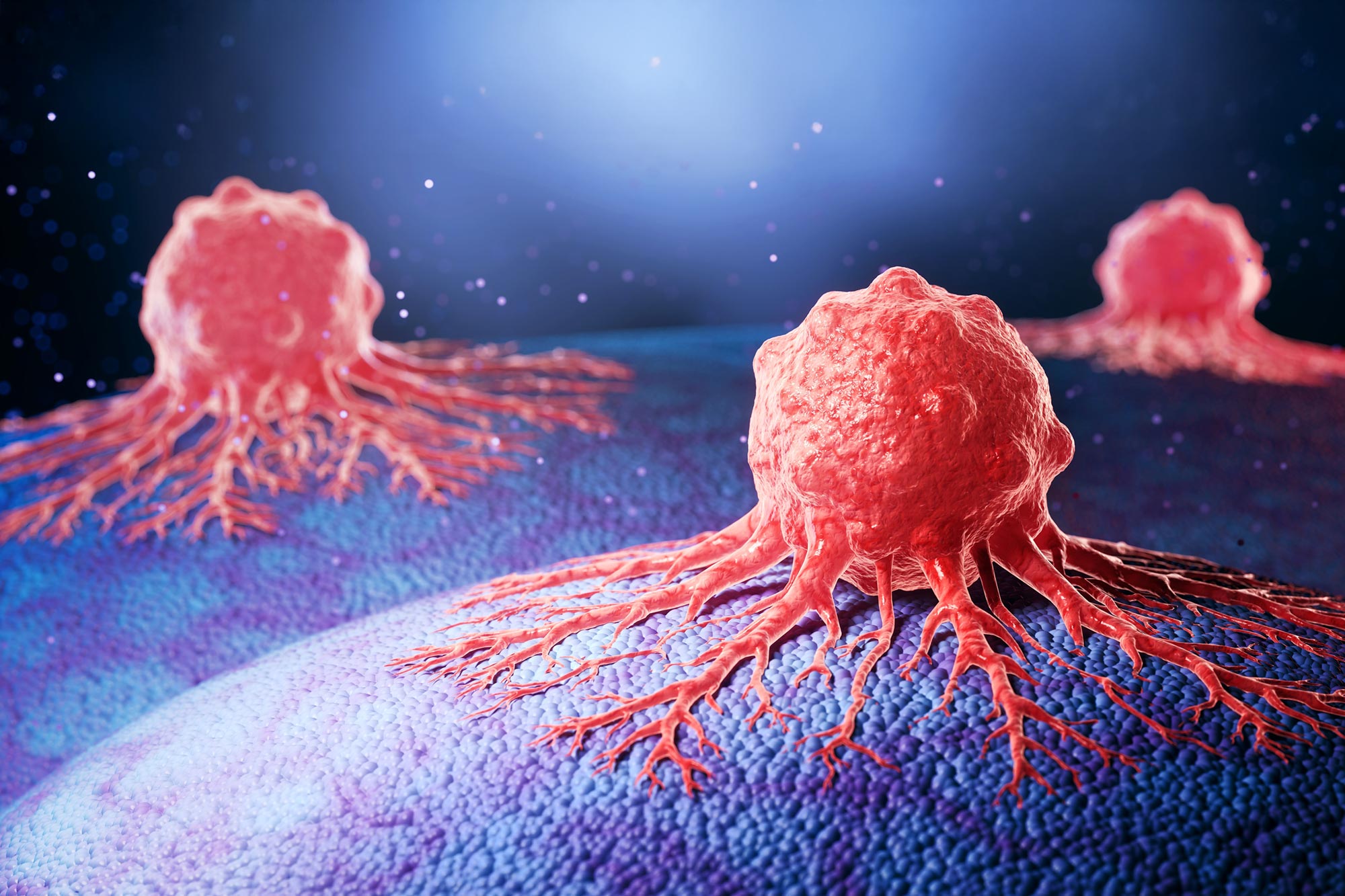 New Strategy May Disrupt Pancreatic Cancer’s Defense Mechanism