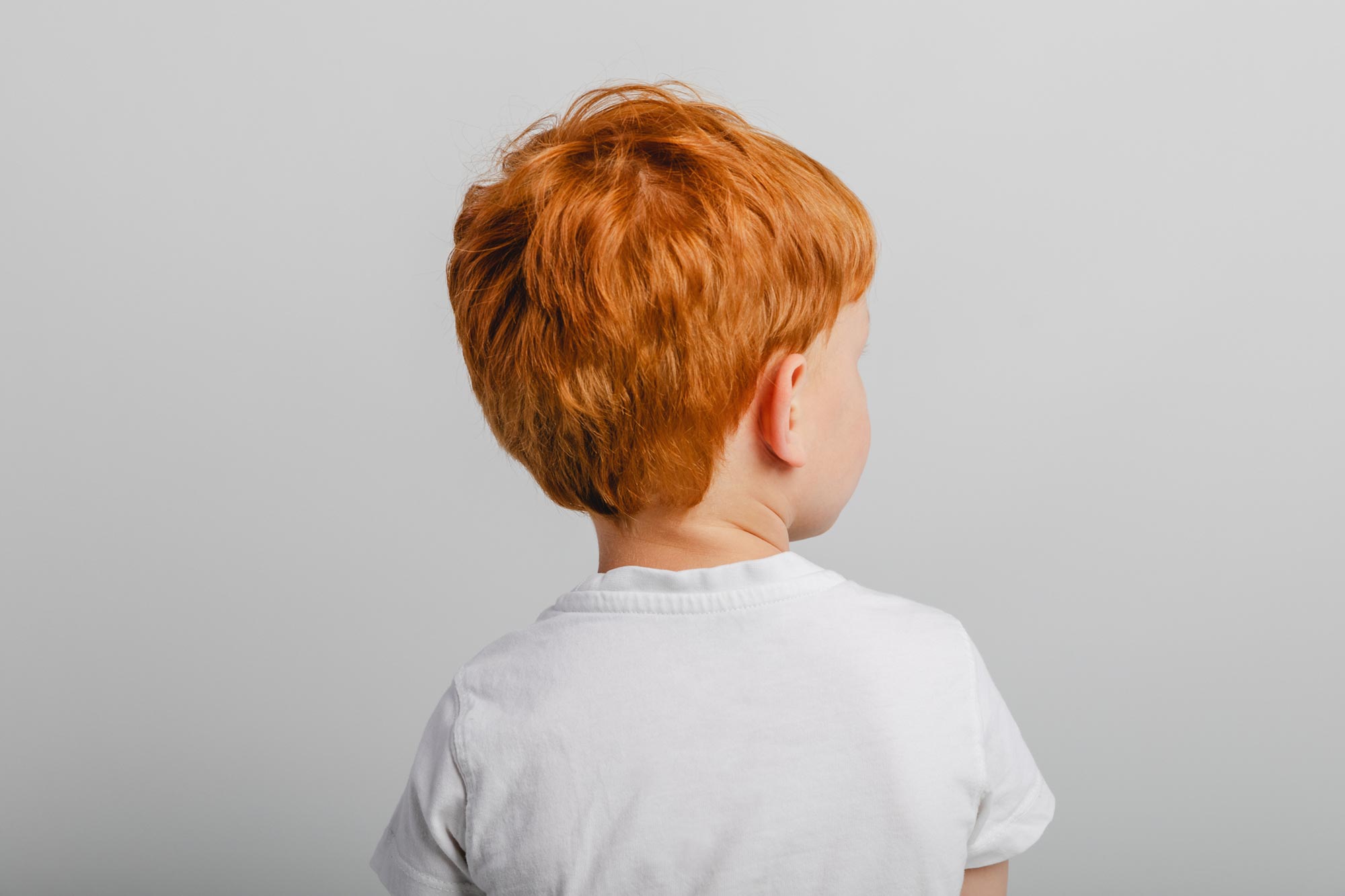 The Unexpected Cellular Advantage of Red Hair Pigment