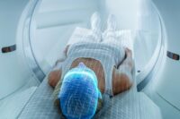 56% of Patients Found with Hidden Prostate Cancer in PSMA PET Scan