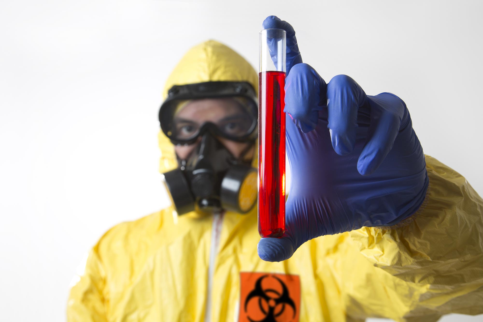 Two Deadly Viruses That Mimic Flu Symptoms Initially
