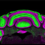 Rethinking Movement Disorders: New Insights From Brain Research
