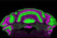 Rethinking Movement Disorders: New Insights From Brain Research