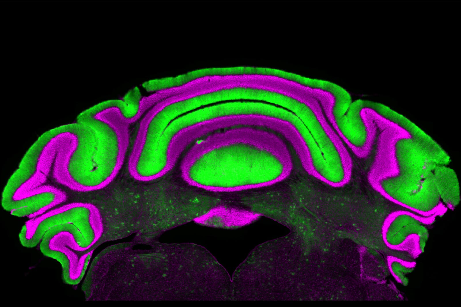 Rethinking Movement Disorders: New Insights From Brain Research