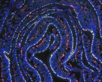 24-Hour Fast Activates Gut-Healing Microbial Pathway