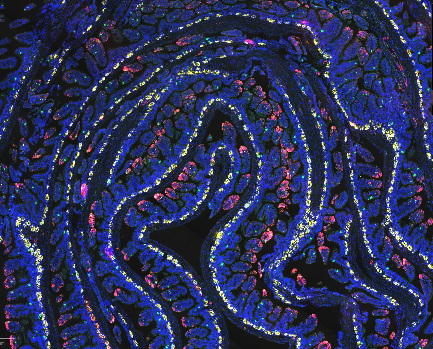 24-Hour Fast Activates Gut-Healing Microbial Pathway
