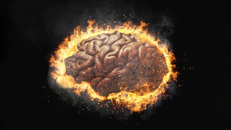 Brain Scans Show Disorders That May Speed Up Brain Aging