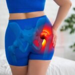 Exercise Aids Hip Arthritis, But Relief May Be Subtle
