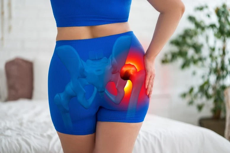 Exercise Aids Hip Arthritis, But Relief May Be Subtle