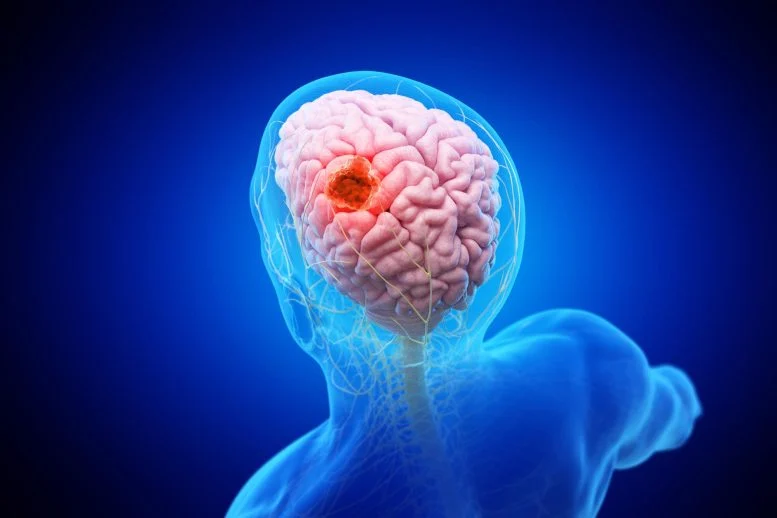 Double Punch Nanoparticle: Targeting and Destroying Brain Cancer