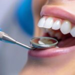 Teeth May Hold Surprising Clue to Pancreatic Cancer Survival