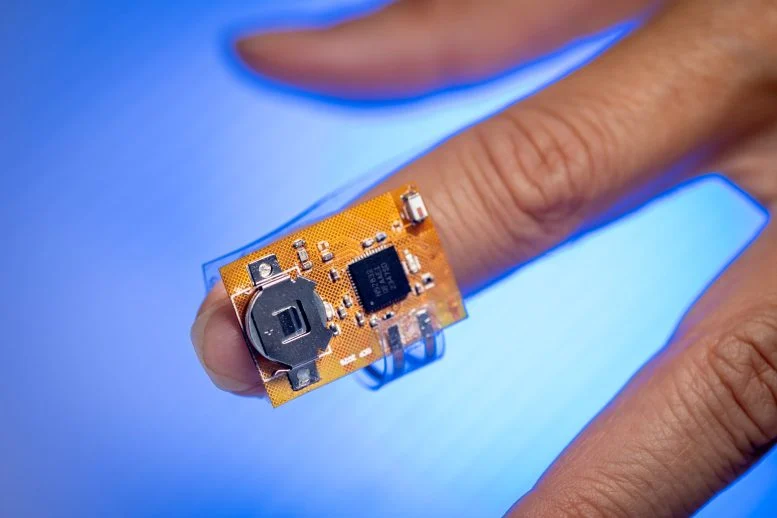 Fingertip Patch Monitors Parkinson’s Medication via Sweat