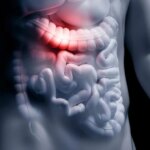 Link Between Common Gut Bacteria Compound and Alzheimer’s Disease