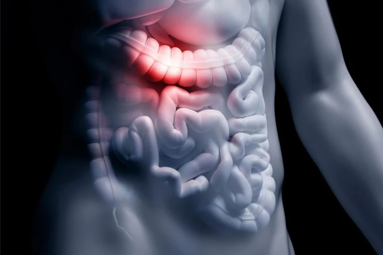 Link Between Common Gut Bacteria Compound and Alzheimer’s Disease