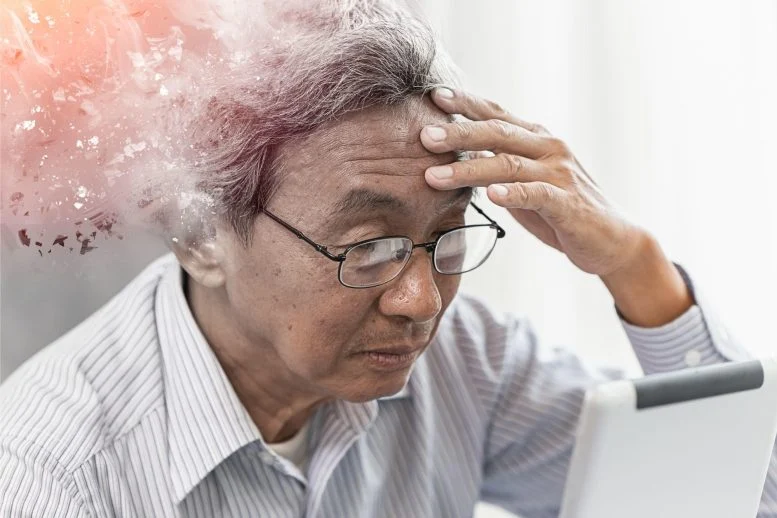 85% of Atypical Alzheimer’s Patients May Be Ineligible for Care